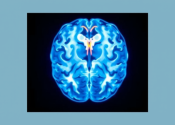 Brain Tumors That Follow Radiation Therapy Come Back Sooner, Study Finds