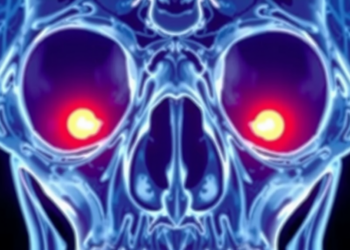 Mystery Eye Socket Spots on Bone Scans Are Almost Always Harmless, Study Finds