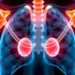 Bone-Protecting Drug Combination Boosts Radiotherapy Against Lung Cancer Spread to Bone