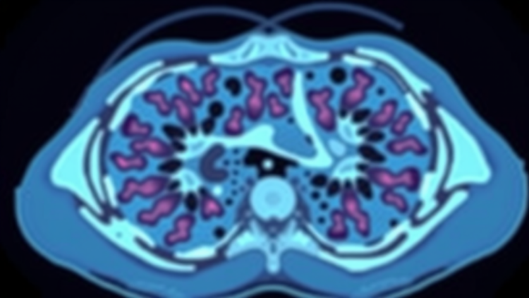 AI Learns to Read Cancer Slides Like a Pathologist by Watching the Neighborhood