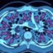 AI Learns to Read Cancer Slides Like a Pathologist by Watching the Neighborhood
