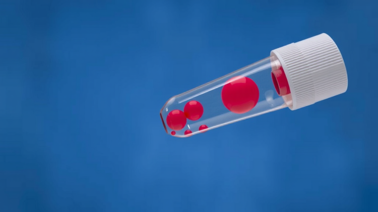 New Mass Spectrometry Assay Tracks 42 Obesity Biomarkers in a Single Blood Test