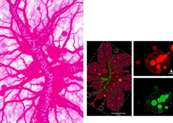 Laser-Dissected Proteomics Reveals Where Immunity Really Lives in Triple-Negative Breast Tumors
