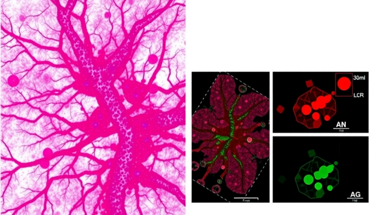 Laser-Dissected Proteomics Reveals Where Immunity Really Lives in Triple-Negative Breast Tumors