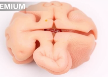 High-Pressure Ventilation Linked to Atypical Skull Suture Fusion in Preterm Infants