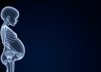 High-Dose Vitamin D in Pregnancy Fails to Strengthen Children’s Bones by Age 13, Landmark Trial Finds