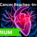 When Cancer Reaches the Heart: Imaging Unravels a Rare Sarcoma Metastasis
