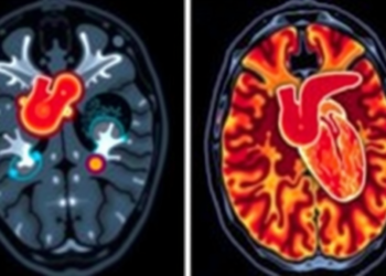 Hidden Heart Damage in Hyperthyroidism Revealed by Advanced MRI Mapping