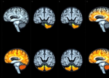 Mixed-Effects Model for Brain Scans Matches Gold Standard and Maps Reliability Across the Whole Brain
