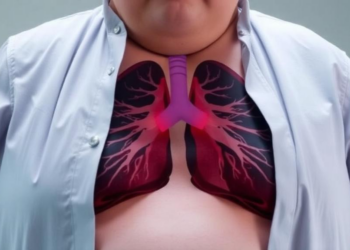 Severe Obesity Reshapes Chest Wall Mechanics in ARDS, Experts Argue for Personalized Ventilation