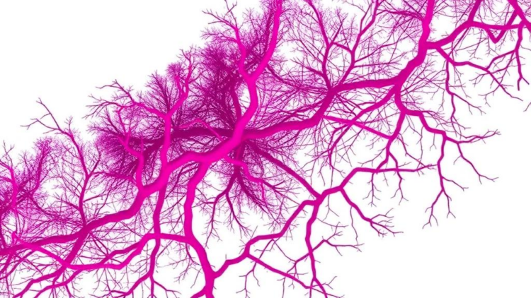 Beyond PIK3CA: Genetic Study Redraws the Map of Childhood Vascular Malformations with Overgrowth