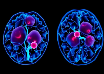 Machine Learning Model Predicts Three-Year Survival in Rare Blood Cancer