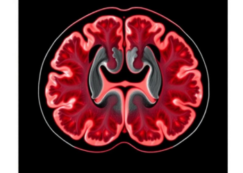 MRI Reveals Hidden Architecture Inside Plant-Based Meat
