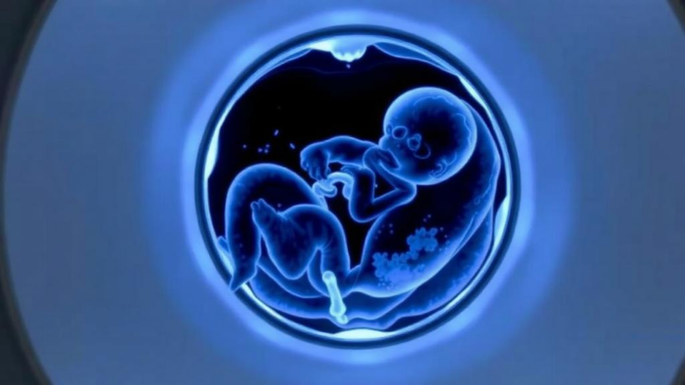 Long-Axis PET Scanner Captures Rare Dynamic Views of Glucose Uptake in the Human Fetus