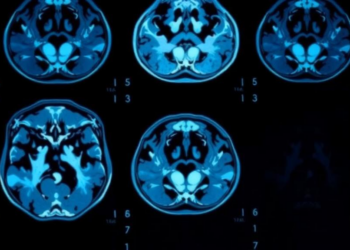 New AI Framework Teaches Itself to Read Medical Scans With Fewer Labels