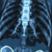 AI Learns to Read Fuzzy Bone Scans and Write Radiology Reports