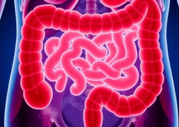 Stent Plus Chemotherapy Before Surgery Boosts Survival in Blocked Colon Cancer