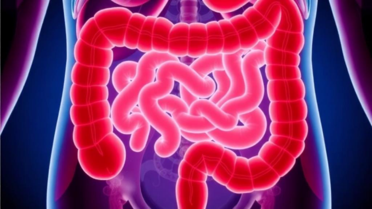 Stent Plus Chemotherapy Before Surgery Boosts Survival in Blocked Colon Cancer