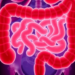 Stent Plus Chemotherapy Before Surgery Boosts Survival in Blocked Colon Cancer