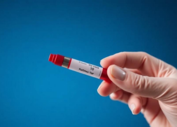 Three Routine Blood Tests May Help Tell IgG4-Related Disease Apart from Lymphoma