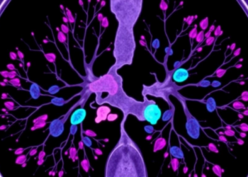 Rare Metaplastic Breast Cancer Shows Weaker Response to Antibody-Drug Conjugate