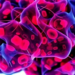 Immune Fingerprints in Blood Reveal Parkinson’s Disease When Patients Are Sorted First