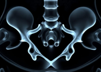 AI Reads Hidden Bone Aging Patterns in Routine CT Scans of the Hip