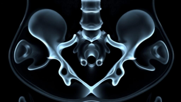 AI Reads Hidden Bone Aging Patterns in Routine CT Scans of the Hip