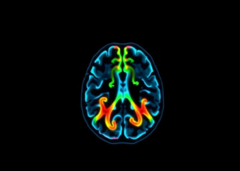 RNA Acetylation Enzyme NAT10 Helps Glioblastoma Resist Radiotherapy