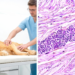 Rare Muscle-Infiltrating T-Cell Lymphoma in a Dog Challenges Diagnosis