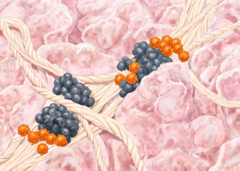 AI maps collagen highways and myeloid roadblocks that trap T cells in pancreatic cancer