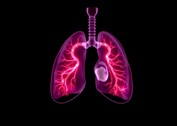 AI Model Spots Dangerous Lung Collapse in Newborns With Unprecedented Accuracy