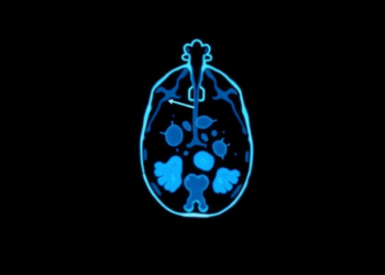 PET Imaging Reveals Whether Immunotherapy Drugs Actually Reach Their Tumour Targets