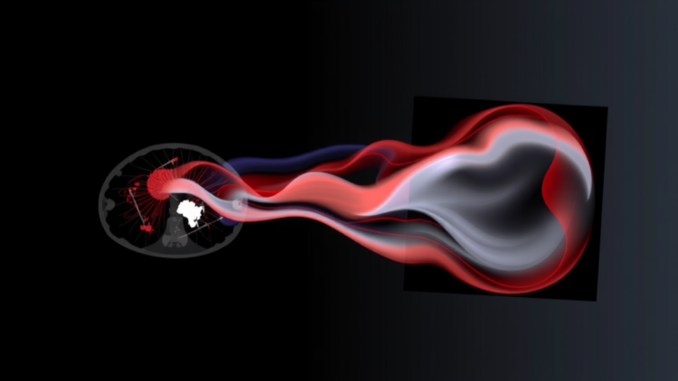 AI Framework Aligns Scanning Medical Images by Separating Motion From Contrast Flow