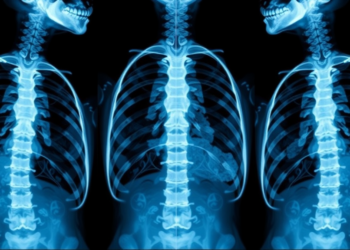 One Sentence in a Radiology Report Tripled Osteoporosis Care After Fractures