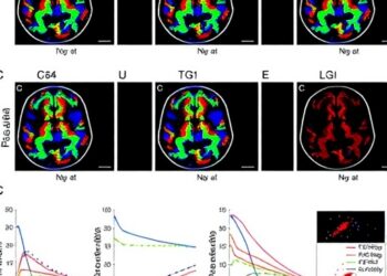TGF-β expression patterns across meningioma grades revealed by multi-omics analysis