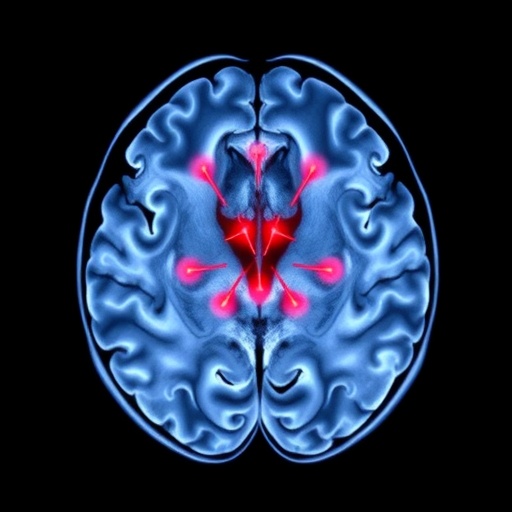 Ultra-high field MRI maps locus coeruleus connectivity in anxiety and PTSD