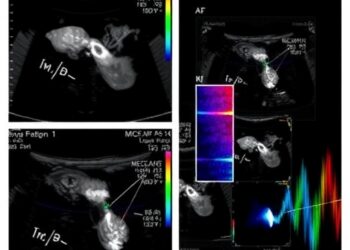 Ultrafast Ultrasound With Phrenic Stimulation Diagnoses Diaphragm Dysfunction Noninvasively