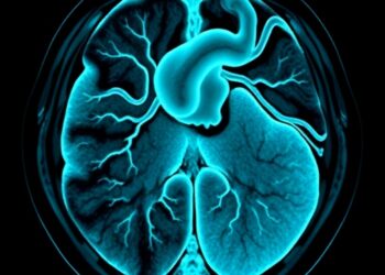 Variational autoencoders detect coronary artery disease in SPECT images