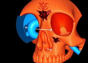 Virtual CT updates tissue resection modeling during endoscopic sinus surgery