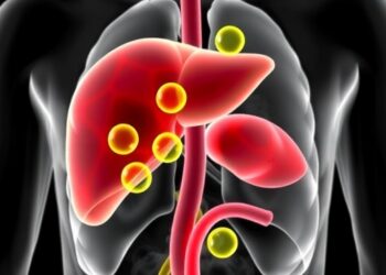 Vitamin E reduces fat buildup and oxidative stress in liver disease model