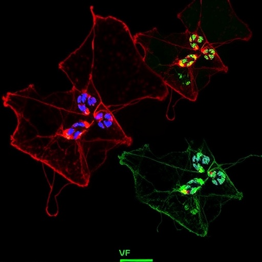 VMA21 loss disrupts autophagy and vesicle trafficking in X-linked myopathy