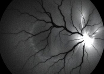 Wavelet-Enhanced Semantic Network Improves Retinal Vessel Segmentation Accuracy