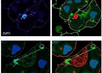 ZUP1 drives cisplatin resistance and Treg signaling in lung cancer