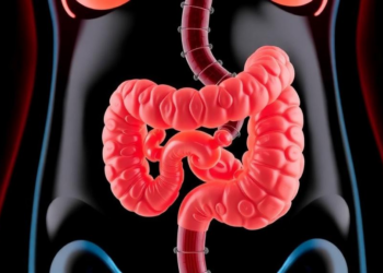 Gut Bacteria and Diet May Explain Why Obesity Sometimes Boosts Cancer Immunotherapy