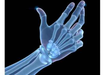 Simple Regression Models Bring Predictive Socket Design Closer for Transradial Prostheses