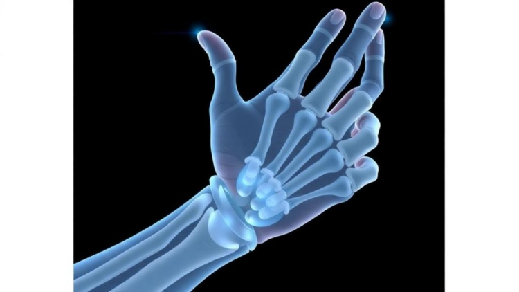 Simple Regression Models Bring Predictive Socket Design Closer for Transradial Prostheses
