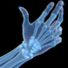 Simple Regression Models Bring Predictive Socket Design Closer for Transradial Prostheses