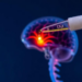 Simple Spinal Fluid Protein Test Could Curb Unnecessary Meningitis PCR Panels