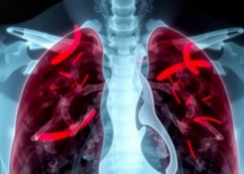 Two Simple Blood Markers After Radiotherapy May Predict Survival in Lung Cancer